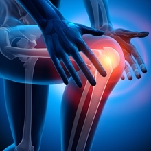 Un idrogel per ripristinare cartilagine del ginocchio danneggiata